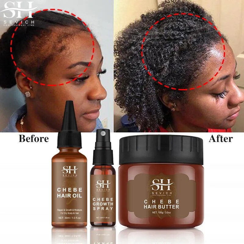 All Chebe Product Crazy Hair Growth Oil African Traction Alopecia Chebe Powder Serum Edges Anti Hair Loss Treatment Spray Sevich