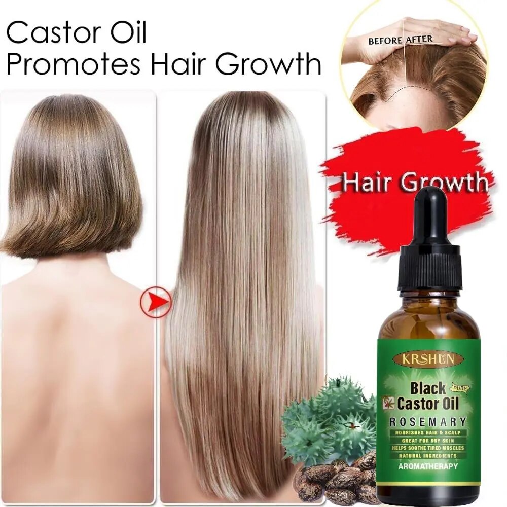 Ginger Black Castor Oil Nourishes Hair Growth Skin Massage Hair Loss Essential Oil Eyebrows Growth Hair Tonic Oil for Men Women