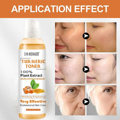 118ml Tumeric Dark Spots Toner Spots Eraser Corrector Turmeric Fade Blemishes Dark Spot Remover Acne Remover Toner for Dark Skin